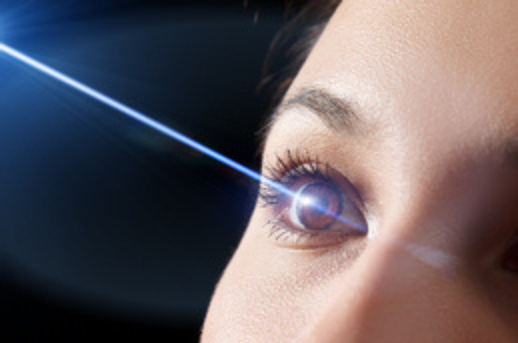 Lasik Laser